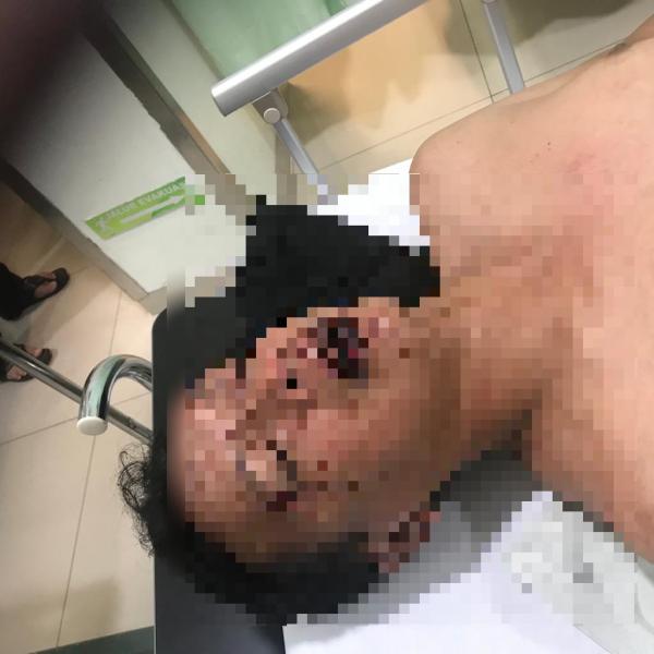 Cemburu, Anak Pejabat Pukulin Warga Pekanbaru hingga Koma